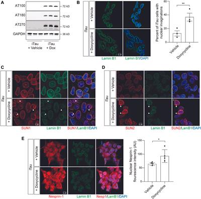 Pathogenic tau decreases nuclear tension in cultured neurons